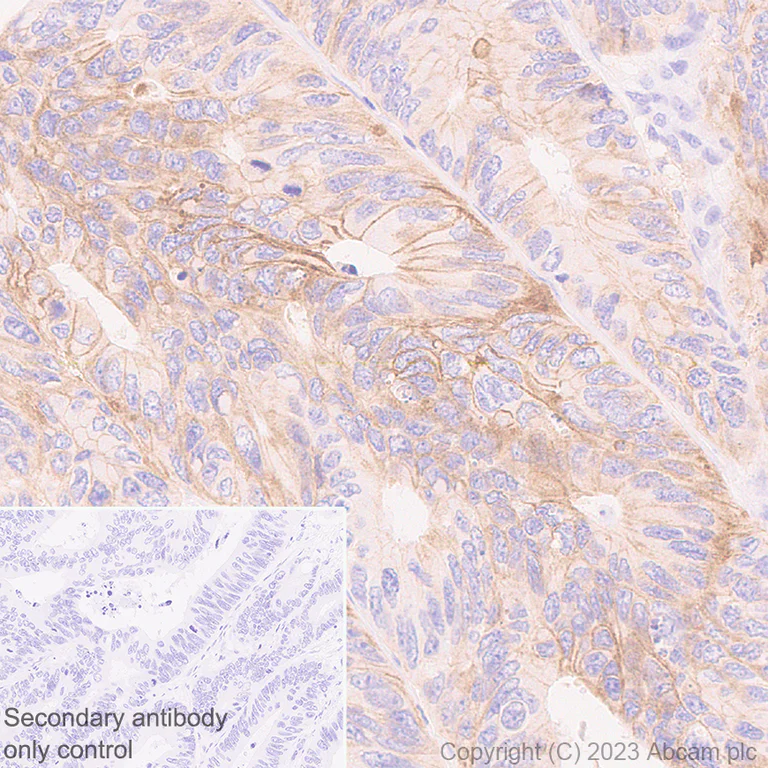 Immunohistochemistry (Formalin/PFA-fixed paraffin-embedded sections) - Anti-HHLA2 antibody [EPR26395-88] - BSA and Azide free (AB315995)