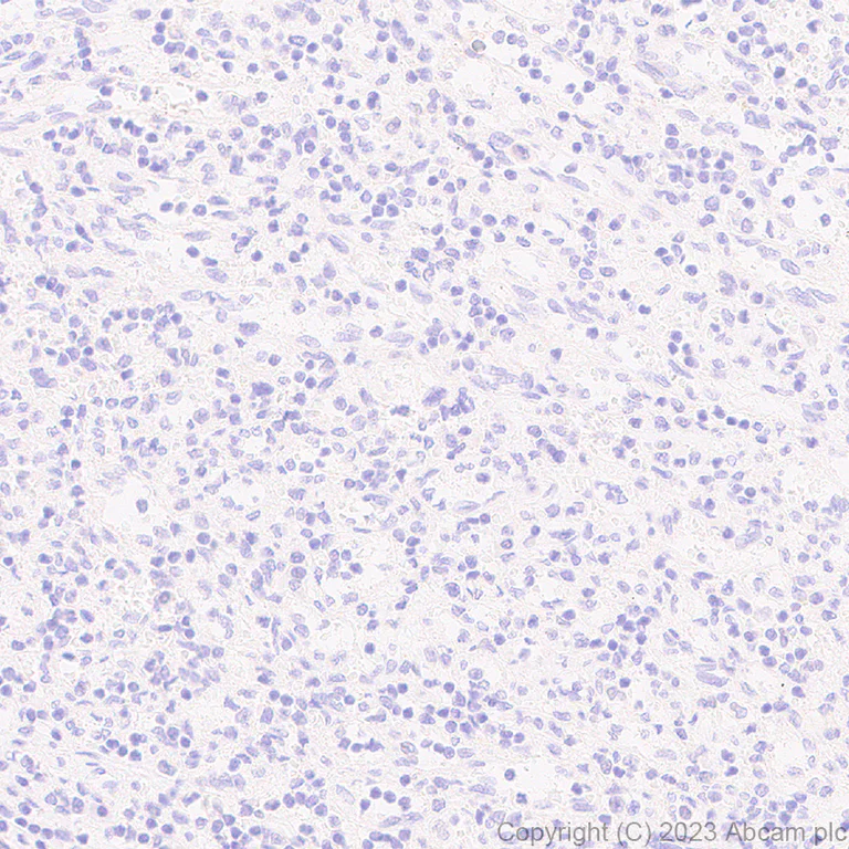 Immunohistochemistry (Formalin/PFA-fixed paraffin-embedded sections) - Anti-HHLA2 antibody [EPR26395-88] - BSA and Azide free (AB315995)