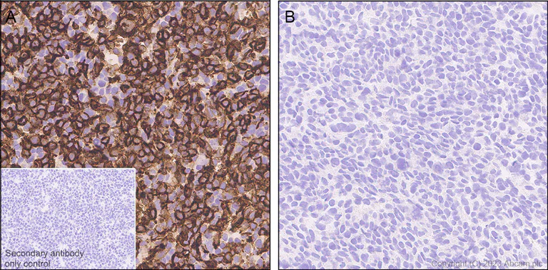 Immunohistochemistry (Formalin/PFA-fixed paraffin-embedded sections) - Anti-HHLA2 antibody [EPR26395-88] - BSA and Azide free (AB315995)