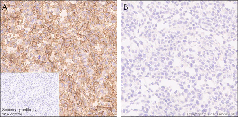 Immunohistochemistry (Formalin/PFA-fixed paraffin-embedded sections) - Anti-HHLA2 antibody [EPR26395-88] - BSA and Azide free (AB315995)