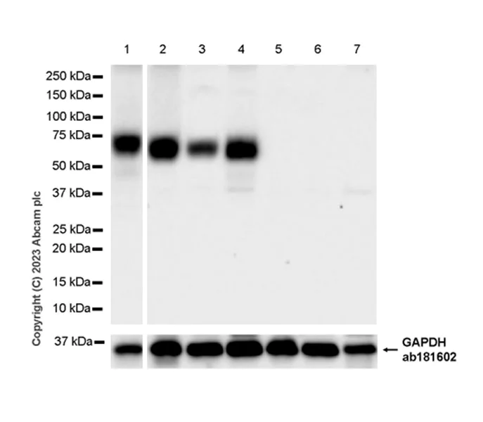 Western blot - Anti-HHLA2 antibody [EPR26395-88] - BSA and Azide free (AB315995)