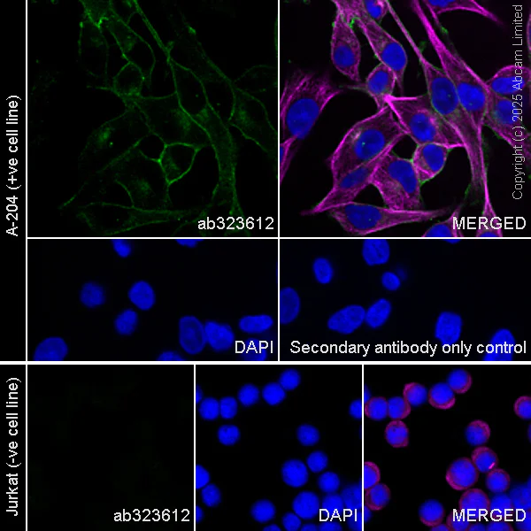 Immunocytochemistry/ Immunofluorescence - Anti-HHLA2 antibody [RM2075] (AB323612)