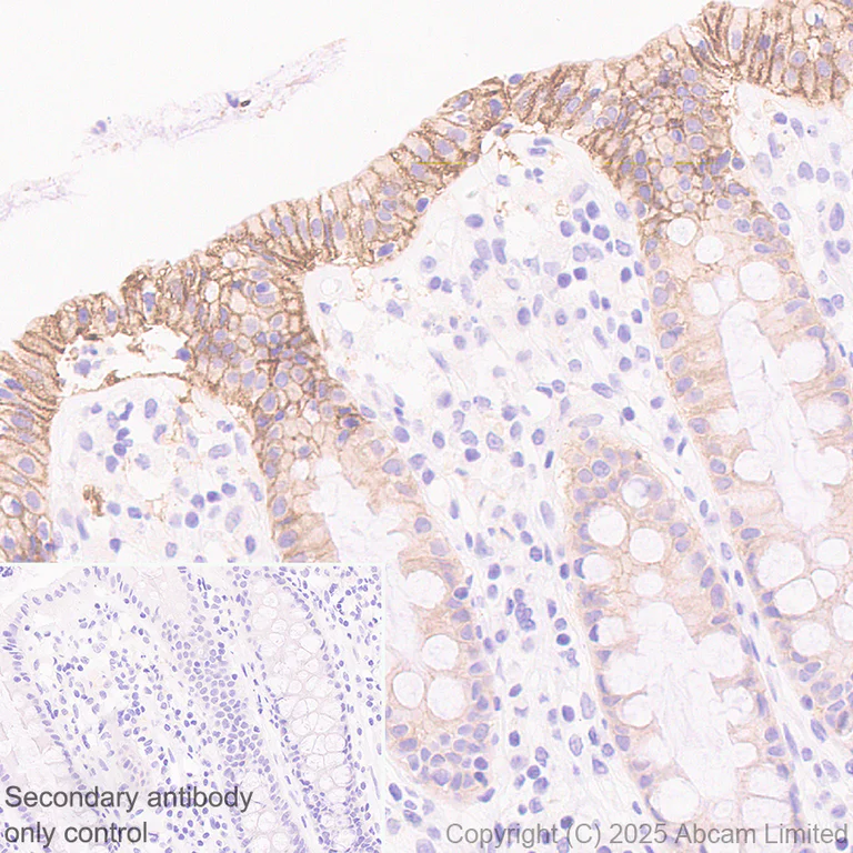 Immunohistochemistry (Formalin/PFA-fixed paraffin-embedded sections) - Anti-HHLA2 antibody [RM2075] (AB323612)
