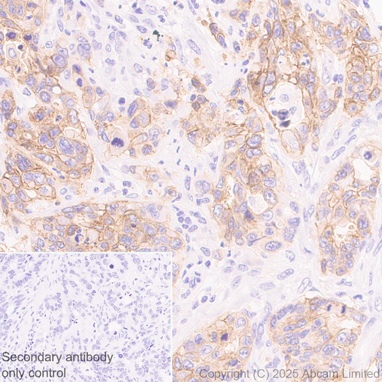 Immunohistochemistry (Formalin/PFA-fixed paraffin-embedded sections) - Anti-HHLA2 antibody [RM2075] (AB323612)