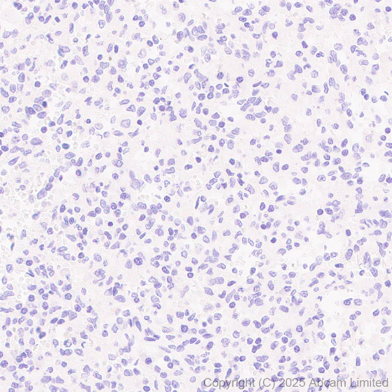Immunohistochemistry (Formalin/PFA-fixed paraffin-embedded sections) - Anti-HHLA2 antibody [RM2075] (AB323612)
