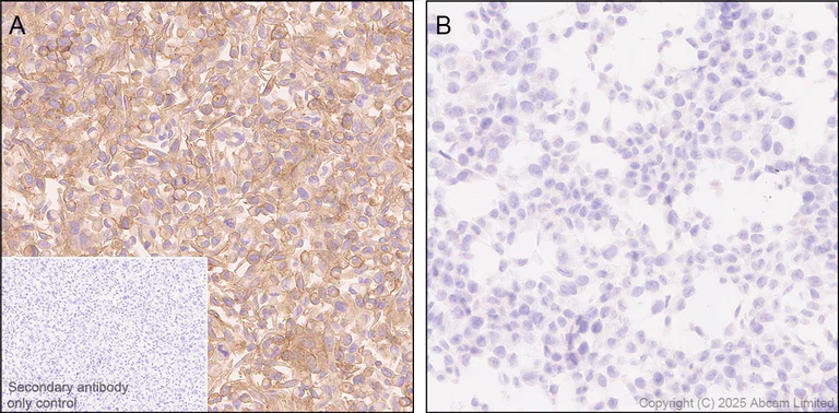 Immunohistochemistry (Formalin/PFA-fixed paraffin-embedded sections) - Anti-HHLA2 antibody [RM2075] (AB323612)