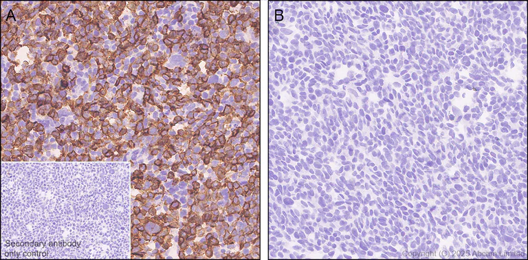 Immunohistochemistry (Formalin/PFA-fixed paraffin-embedded sections) - Anti-HHLA2 antibody [RM2075] (AB323612)