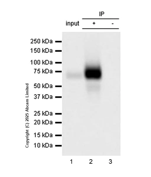 Immunoprecipitation - Anti-HHLA2 antibody [RM2075] (AB323612)