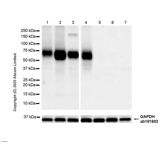 Western blot - Anti-HHLA2 antibody [RM2075] (AB323612)