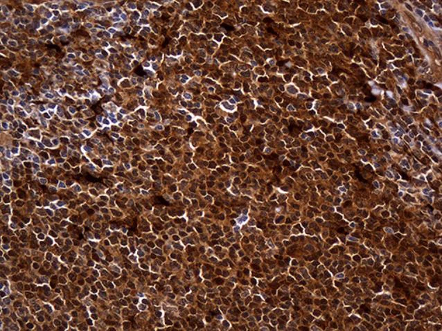 Immunohistochemistry (Formalin/PFA-fixed paraffin-embedded sections) - Anti-HHLA3 antibody [OTI10B4] (AB279373)