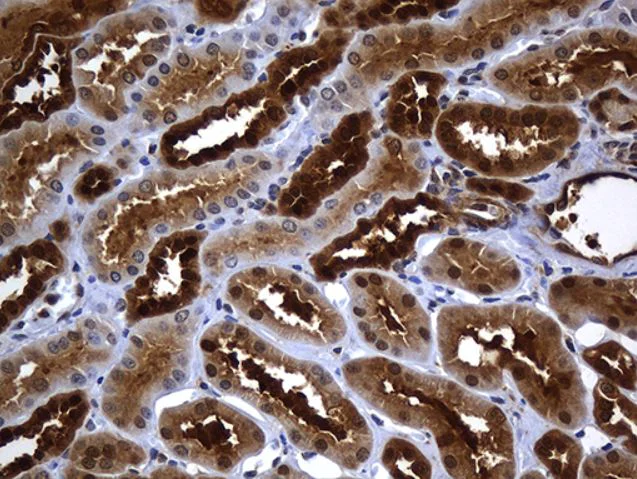 Immunohistochemistry (Formalin/PFA-fixed paraffin-embedded sections) - Anti-HHLA3 antibody [OTI10B4] (AB279373)