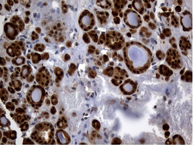 Immunohistochemistry (Formalin/PFA-fixed paraffin-embedded sections) - Anti-HHLA3 antibody [OTI10B4] (AB279373)