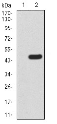 Western blot - Anti-hHR23A antibody [1E4D6] (AB233795), expandable thumbnail