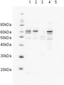 Western blot - Anti-hHR23A antibody (AB3836), expandable thumbnail