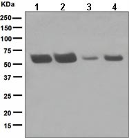 Western blot - Anti-hHR23A antibody [EPR4817] (AB108591), expandable thumbnail