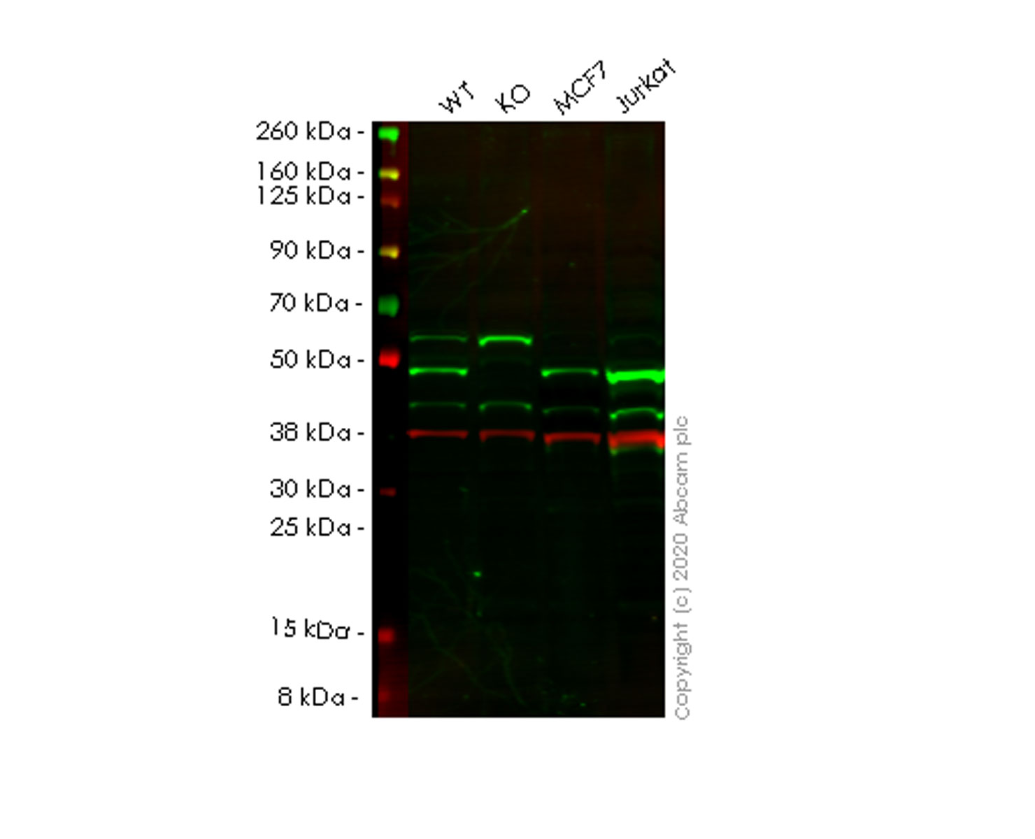 Western blot - Anti-hHR23A antibody [EPR4817] (AB108591), expandable thumbnail