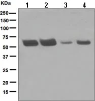 Western blot - Anti-hHR23A antibody [EPR4817] - BSA and Azide free (AB247689)