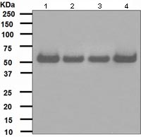 Western blot - Anti-hHR23A antibody [EPR4818] (AB108592), expandable thumbnail