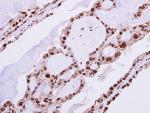 Immunohistochemistry (Formalin/PFA-fixed paraffin-embedded sections) - Anti-hHR23b antibody (AB125918)