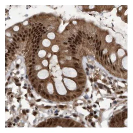 Immunohistochemistry (Formalin/PFA-fixed paraffin-embedded sections) - Anti-hHR23b antibody (AB223776)