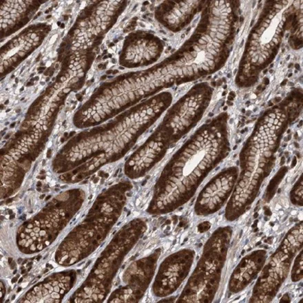 Immunohistochemistry (Formalin/PFA-fixed paraffin-embedded sections) - Anti-hHR23b antibody (AB223776)
