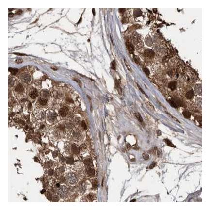 Immunohistochemistry (Formalin/PFA-fixed paraffin-embedded sections) - Anti-hHR23b antibody (AB223776)