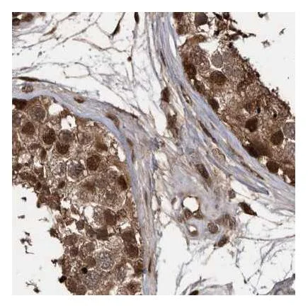 Immunohistochemistry (Formalin/PFA-fixed paraffin-embedded sections) - Anti-hHR23b antibody (AB223776)