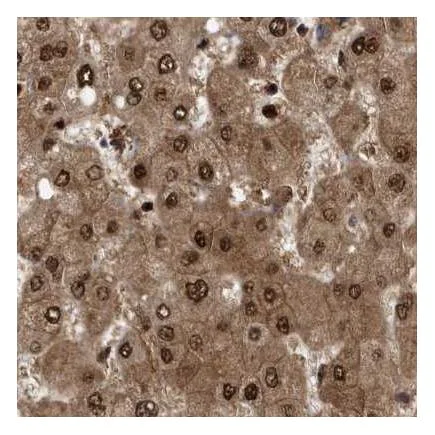 Immunohistochemistry (Formalin/PFA-fixed paraffin-embedded sections) - Anti-hHR23b antibody (AB223776)