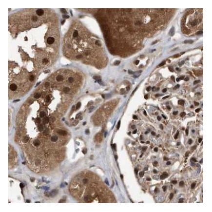 Immunohistochemistry (Formalin/PFA-fixed paraffin-embedded sections) - Anti-hHR23b antibody (AB223776)