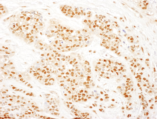 Immunohistochemistry (Formalin/PFA-fixed paraffin-embedded sections) - Anti-hHR23b antibody (AB86781)