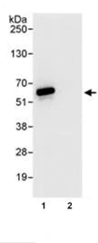 Immunoprecipitation - Anti-hHR23b antibody (AB86781)