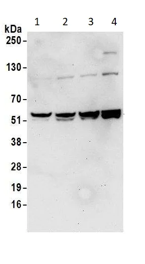 Western blot - Anti-hHR23b antibody (AB86781)