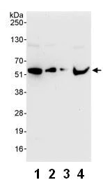 Western blot - Anti-hHR23b antibody (AB86781)