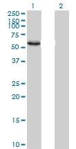Western blot - Anti-hHR23b antibody (AB88503)