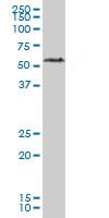 Western blot - Anti-hHR23b antibody (AB88503)