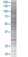 hHR23b overexpression 293T lysate (whole cell)