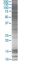 SDS-PAGE - hHR23b overexpression 293T lysate (whole cell) (AB94299), expandable thumbnail