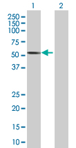 Western blot - hHR23b overexpression 293T lysate (whole cell) (AB94299), expandable thumbnail