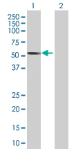 Western blot - hHR23b overexpression 293T lysate (whole cell) (AB94299)