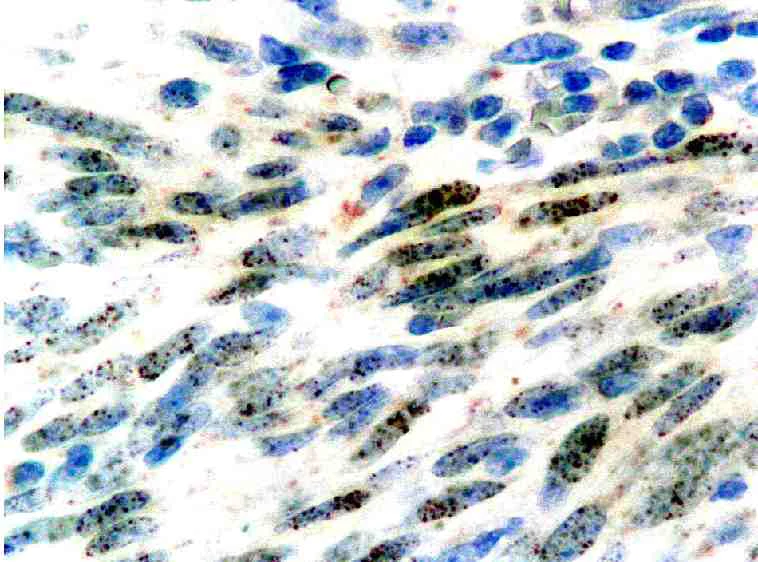 Immunohistochemistry (Formalin/PFA-fixed paraffin-embedded sections) - Anti-HHV8 antibody [LN53] (AB4103)