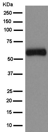 Western blot - Anti-HIAT1 antibody [EPR9642] (AB181050), expandable thumbnail