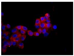 Immunocytochemistry/ Immunofluorescence - Anti-HIBADH antibody [EPR12519(B)] (AB175203), expandable thumbnail