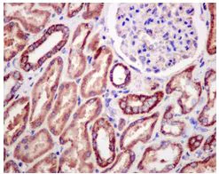 Immunohistochemistry (Formalin/PFA-fixed paraffin-embedded sections) - Anti-HIBADH antibody [EPR12519(B)] (AB175203)