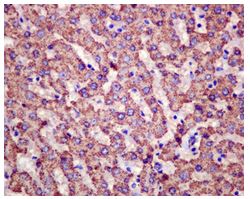 Immunohistochemistry (Formalin/PFA-fixed paraffin-embedded sections) - Anti-HIBADH antibody [EPR12519(B)] (ab175203), expandable thumbnail