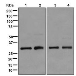 Western blot - Anti-HIBADH antibody [EPR12519(B)] (ab175203), expandable thumbnail