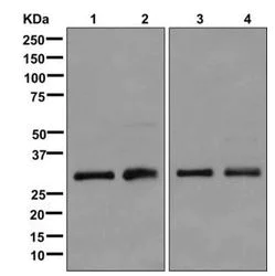 Western blot - Anti-HIBADH antibody [EPR12519(B)] (AB175203)