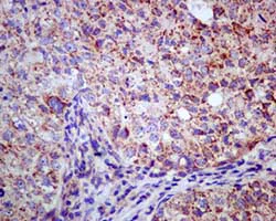 Immunohistochemistry (Formalin/PFA-fixed paraffin-embedded sections) - Anti-HIBADH antibody [EPR12525(B)] (AB172955)