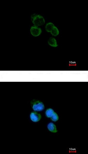 Immunocytochemistry/ Immunofluorescence - Anti-HIBCH antibody (AB153826), expandable thumbnail