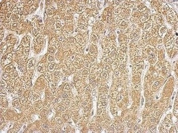 Immunohistochemistry (Formalin/PFA-fixed paraffin-embedded sections) - Anti-HIBCH antibody (AB153826), expandable thumbnail