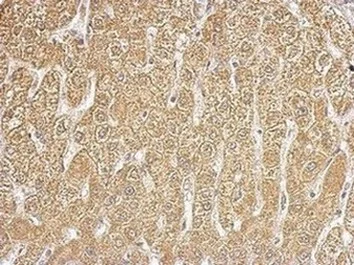 Immunohistochemistry (Formalin/PFA-fixed paraffin-embedded sections) - Anti-HIBCH antibody (AB153826)